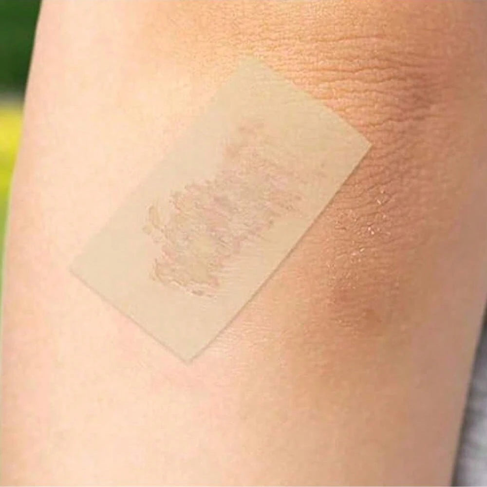 1 Roll Hydrocolloid Roll, Scar Concealing Patch, Large Hydrocolloid Patch, Self-Adhesive, Super Absorbent, Flexible And Waterproof, DIY Size, 5cm*100cm