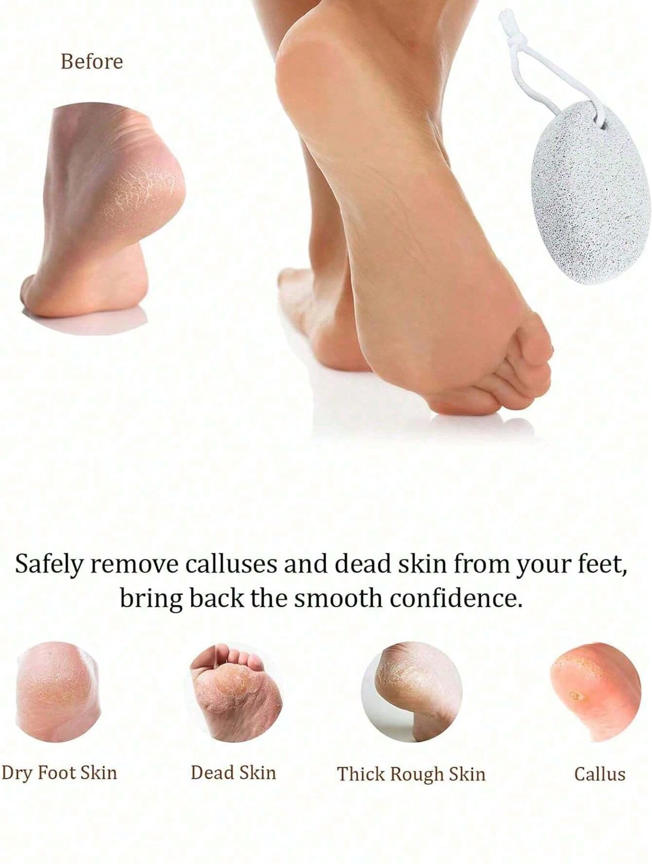 Natural Pumice Stone, Reusable Pedicure Tools,Hard Skin Callus Remover For Feet And Hands, Callus Remover With Pumice Stone,Professional Pedicure Tool Set,Foot Scrub, For Heavy Callused Feet Hands & D