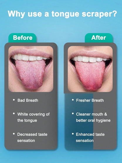 Stainless Steel Tongue Scraper, 3 Styles Available, Rust-Resistant And Durable, Effectively Removes Bad Breath, Cleans Tongue Coating, Portable And Easy To Use, Suitable For Adults And Children Daily